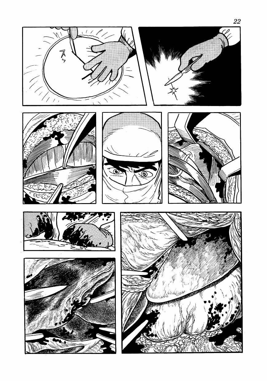 Bác Sĩ Quái Dị: Chapter 150