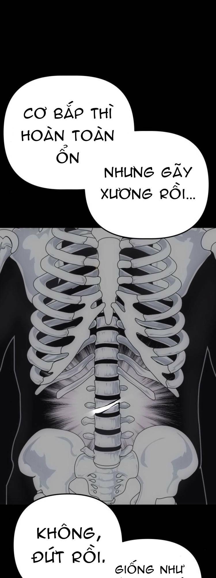 Vua Đóng Cọc: Chapter 17