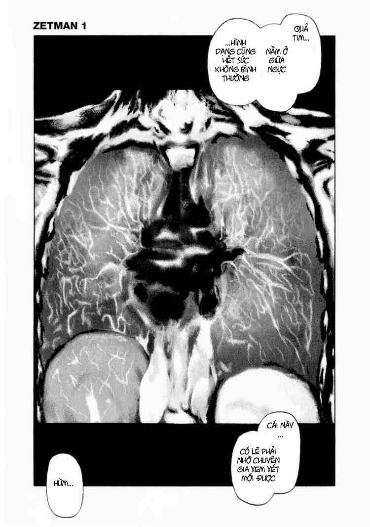 Vợ Yêu Không Ngoan: Chapter 11